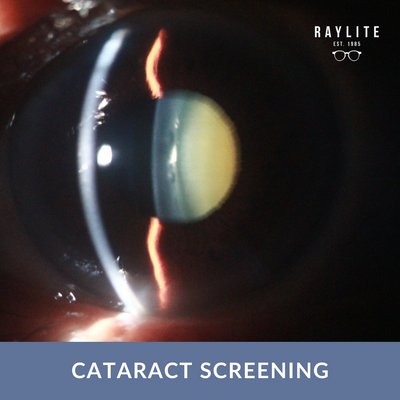 Cataract Screening - Raylite Optical Store