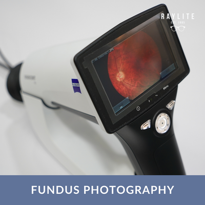 Fundus Photography - Raylite Optical Store
